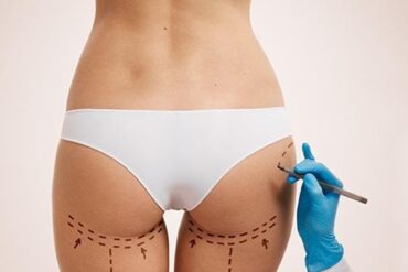 Massage des seins – traitement pour amélioration naturelle des seins