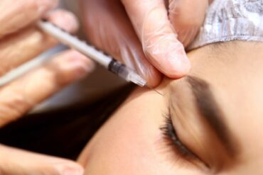 Injection lèvre ratée : comment la corriger ?