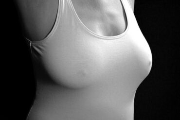Pourquoi le Lipofilling 360 est la Meilleure Technique en 2024